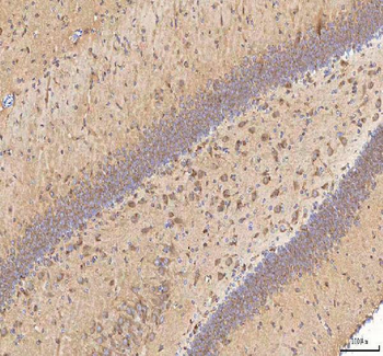 Anti-BPNT2 Antibody