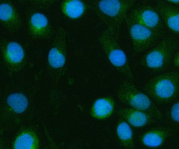 Anti-BPNT2 Antibody