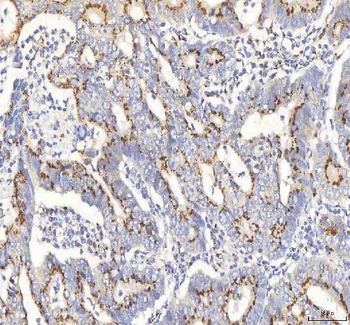 Anti-BPNT2 Antibody