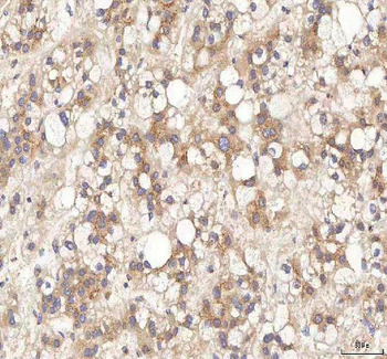 Anti-BPNT2 Antibody