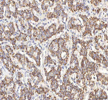 Anti-BPNT2 Antibody