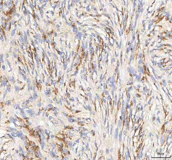 Anti-BPNT2 Antibody