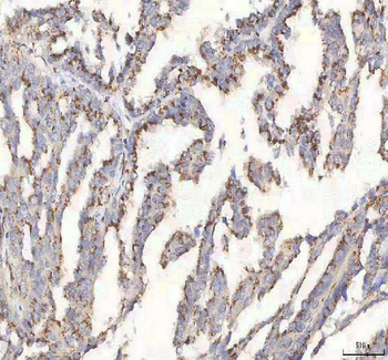 Anti-BPNT2 Antibody