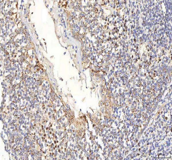 Anti-BPNT2 Antibody