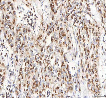 Anti-BPNT2 Antibody