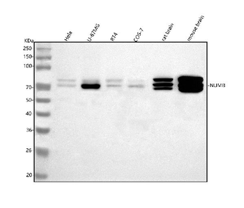 Anti-NUMB Antibody