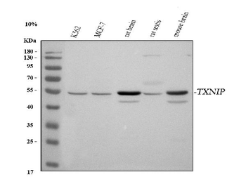 Anti-TXNIP Antibody
