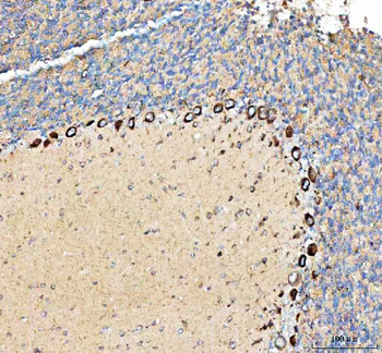Anti-PELI3 Antibody