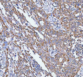Anti-PELI3 Antibody