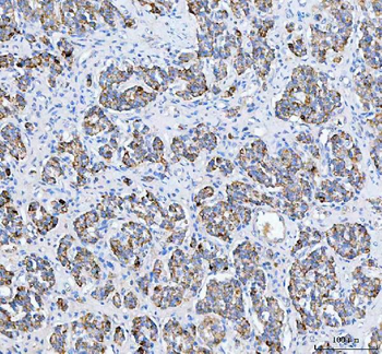 Anti-PELI3 Antibody