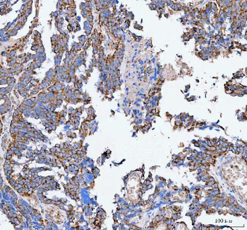 Anti-PELI3 Antibody