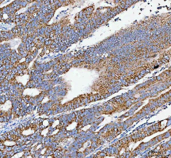Anti-PELI3 Antibody