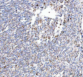 Anti-PELI3 Antibody