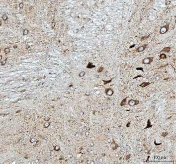 Anti-PELI3 Antibody