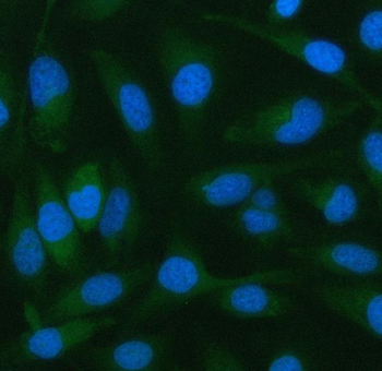 Anti-PELI2 Antibody