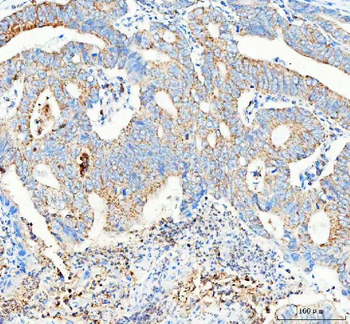 Anti-PELI2 Antibody