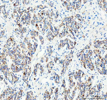 Anti-PELI2 Antibody