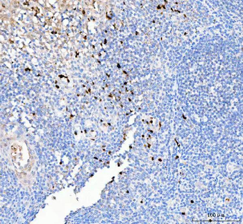 Anti-PELI2 Antibody