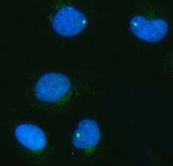 Anti-PDK3 Antibody