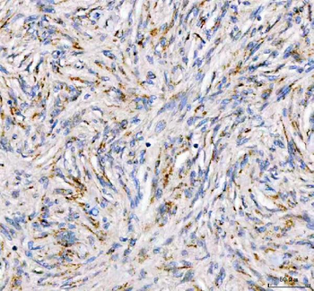 Anti-PDK3 Antibody