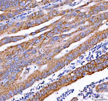 Anti-PDK3 Antibody