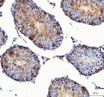 Anti-PDK3 Antibody