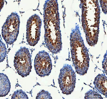 Anti-PDK3 Antibody