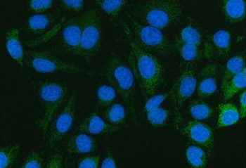 Anti-Pyruvate Carboxylase/PC Antibody