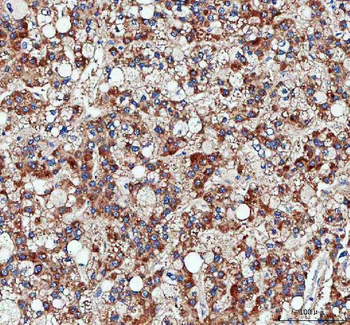 Anti-Pyruvate Carboxylase/PC Antibody