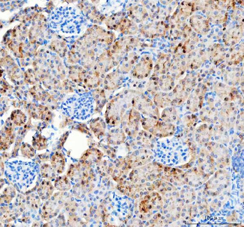 Pyruvate Carboxylase/PC Antibody