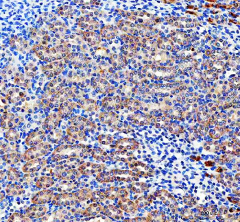 Anti-Pyruvate Carboxylase/PC Antibody