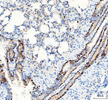 Anti-PARP3 Antibody