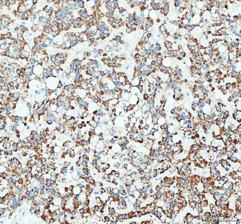 Anti-RAB3IP Antibody