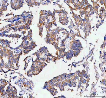 Anti-RAB3IP Antibody