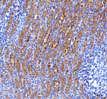 Anti-RAB3IP Antibody