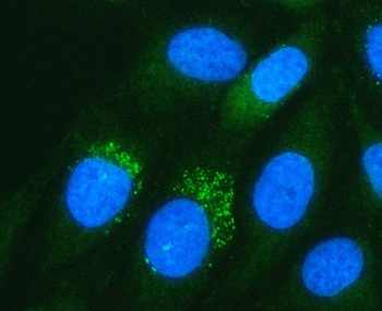 Anti-PADI3 Antibody