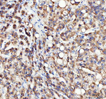 Anti-INSIG1 Antibody