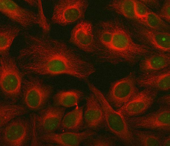 Anti-ING2 Antibody