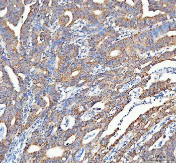 Anti-ATG7 Antibody