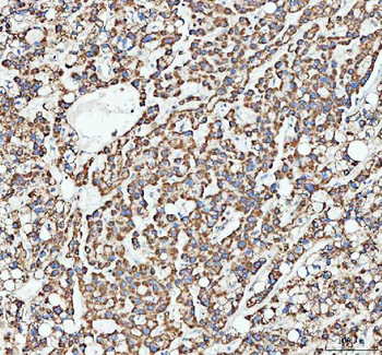 Anti-ATG7 Antibody