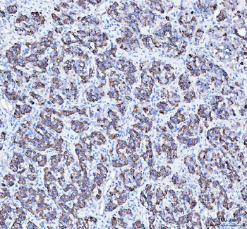 Anti-ATG7 Antibody