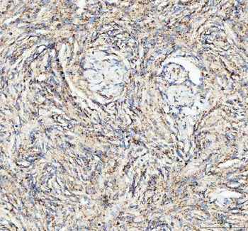 Anti-ATG7 Antibody