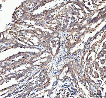 Anti-ATG7 Antibody