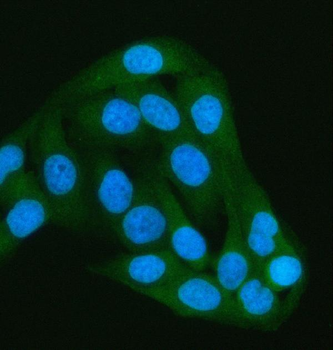 Anti-PAIP1 Antibody