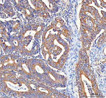 Anti-PAIP1 Antibody