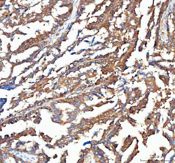 Anti-OTUB1 Antibody