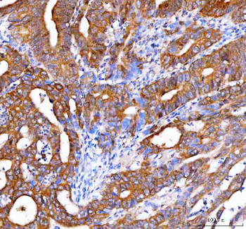 Anti-OTUB1 Antibody