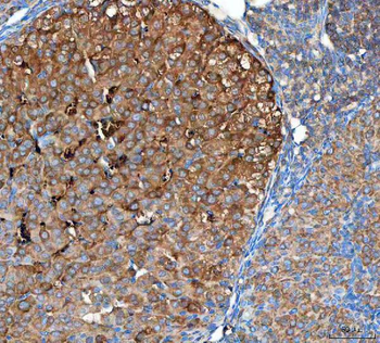 Anti-OTUB1 Antibody