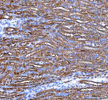 Anti-PARD6B Antibody
