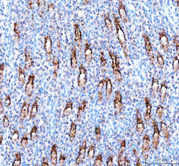 Anti-PARD6B Antibody
